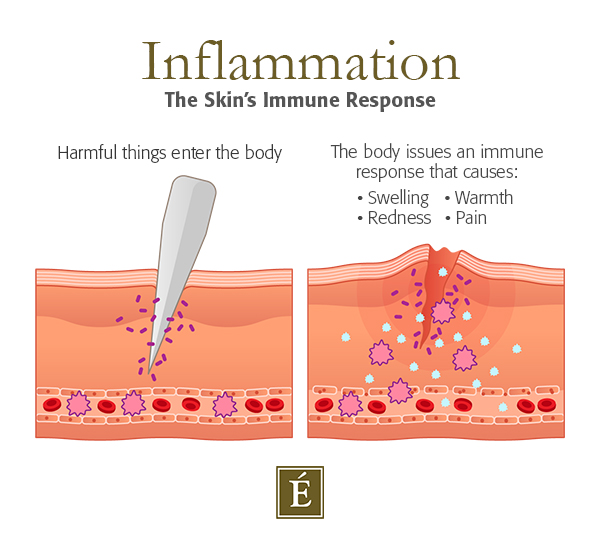 eminence-organics-inflammation-skin