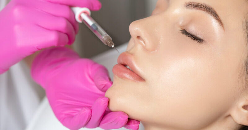 Introlift-First-Time-Getting-Lip-Fillers-Heres-What-to-Expect-Filler (1)
